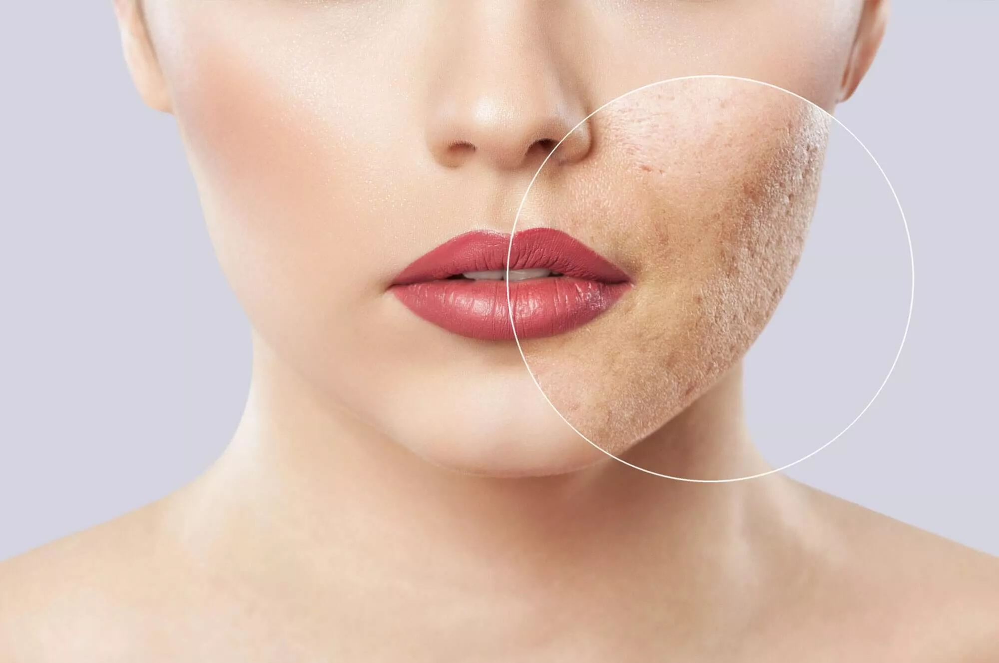 Dermatoloqla Çapıq Müalicəsi: Dəridəki İzlərdən Qurtulmaq Mümkündürmü?