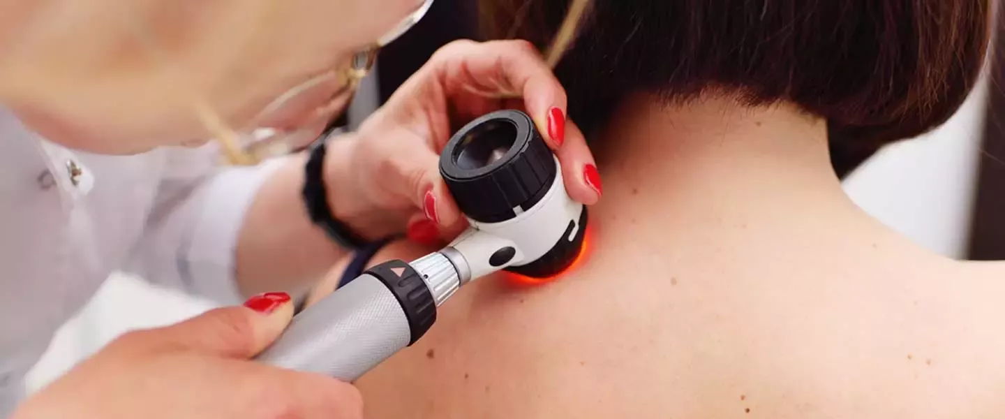 Ziyil nədir? Yaranma səbəbləri və effektiv müalicə üsulları – Dermatoloq izah edir