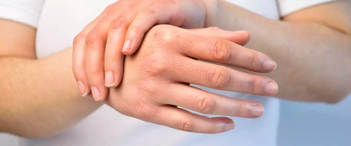 Dermatoloq Fəridə Axundova - Quru dəri haqqında