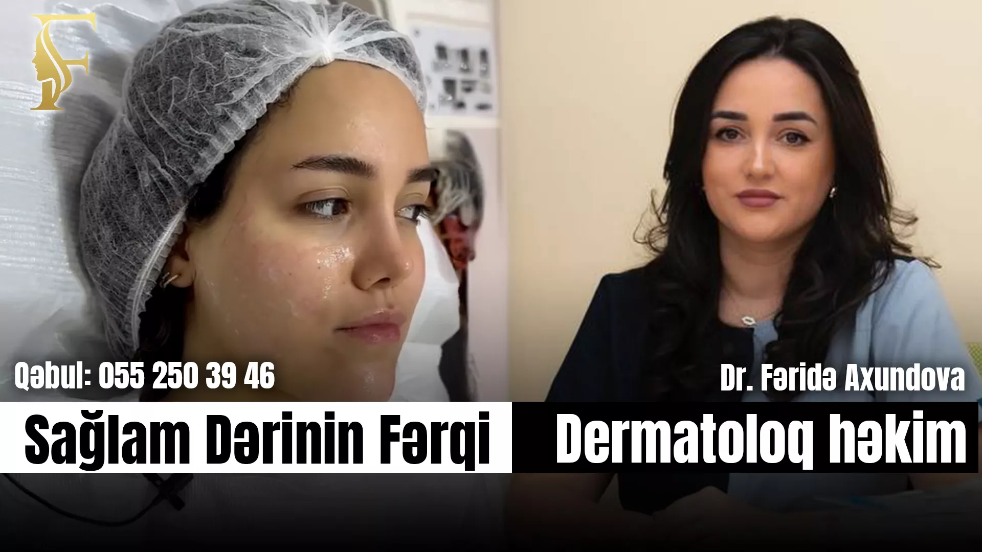 Sızanaqlı Dəriyə Düzgün Baxım