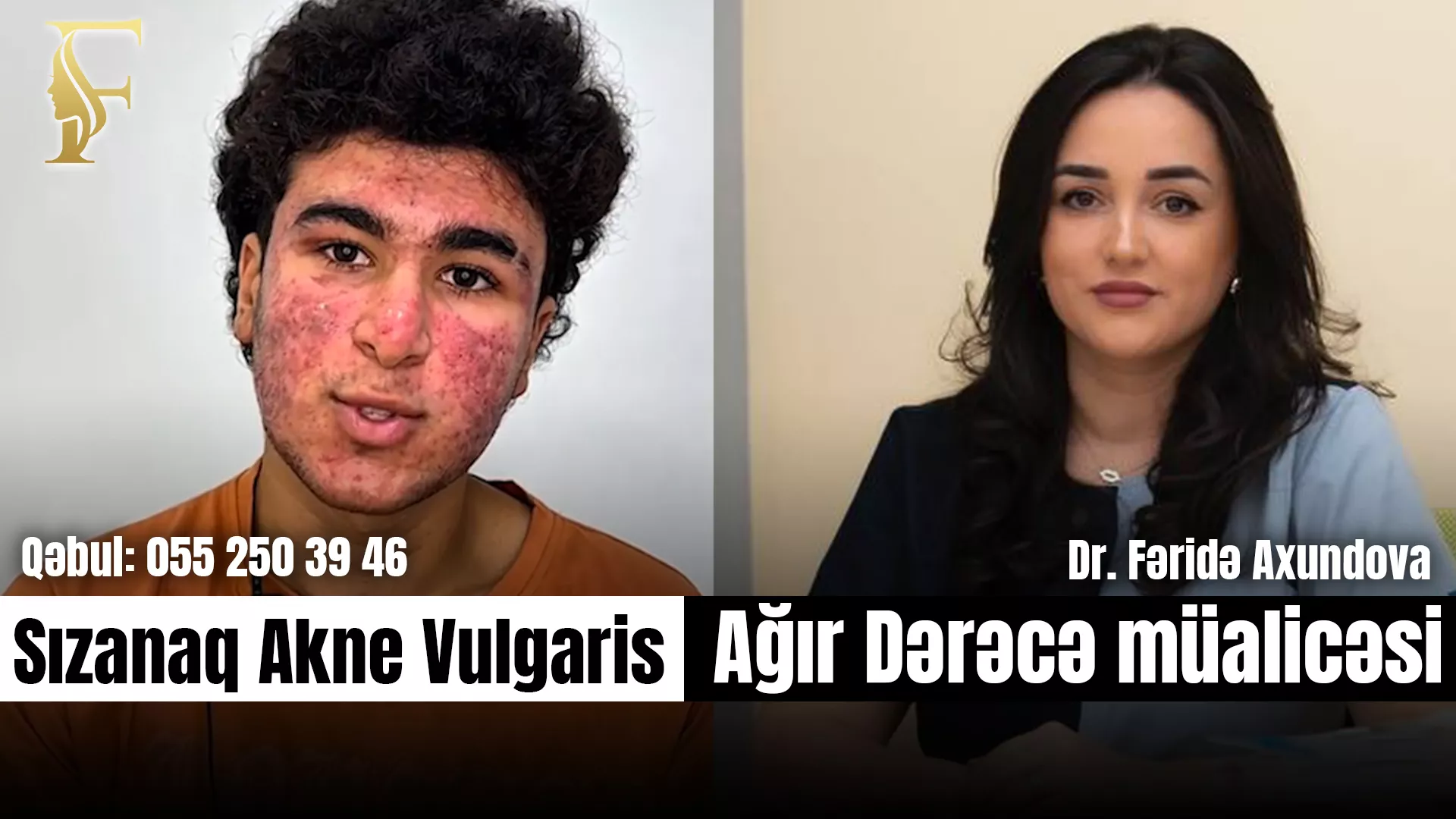 Dermatoloq Dr. Fəridə Axundova  Dəri xəstəlikləri və Sızanaq