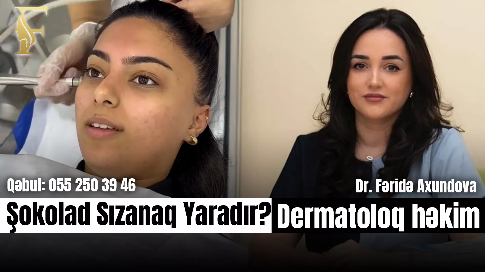 Şokolad Dəri Problemlərinə Səbəb Ola Bilərmi?